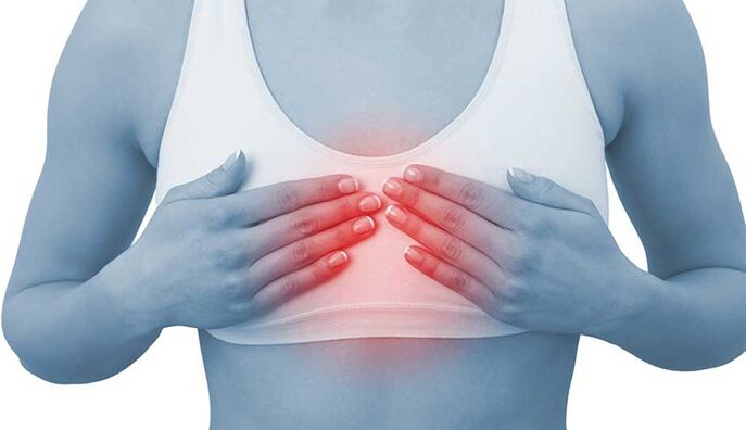 La douleur avec chondose mammaire peut imiter le chagrin