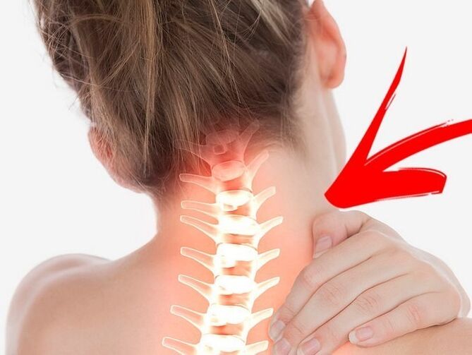 Compression des racines nerveuses avec ostéochondrose cervicale